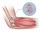 Tennis Elbow_Exercise Physiology Melbourne